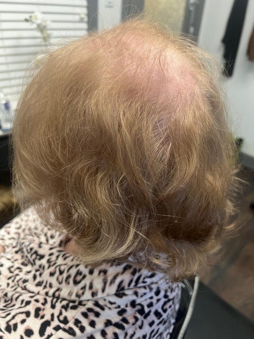 hair-topper-before-2 (839) hair-topper-before-2 (839)